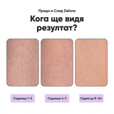 Delora: Гладка кожа за минути